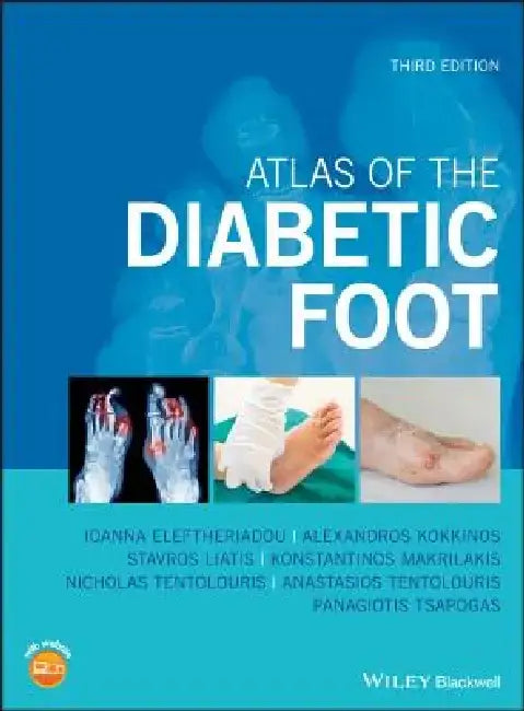 Atlas of the Diabetic Foot by Nikolaos Tentolouris