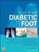Atlas of the Diabetic Foot by Nikolaos Tentolouris