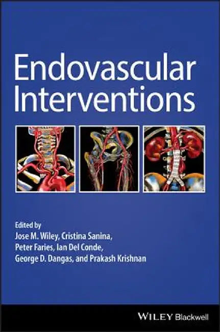 Endovascular Interventions by Jose M. Wiley