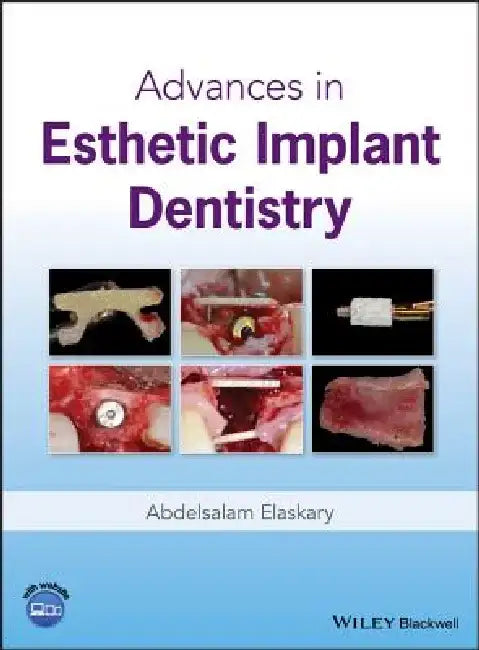 Advances in Esthetic Implant Dentistry by Abd El Salam El Askary