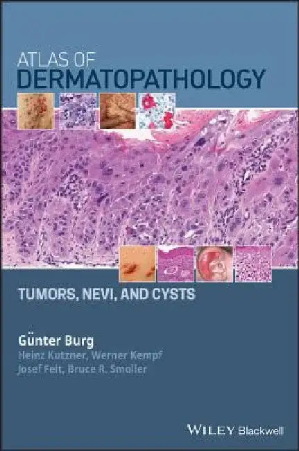 Atlas of Dermatopathology: Tumors, Nevi, and Cysts by Gunter Burg