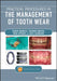 Practical Procedures in the Management of Tooth Wear by Subir Banerji