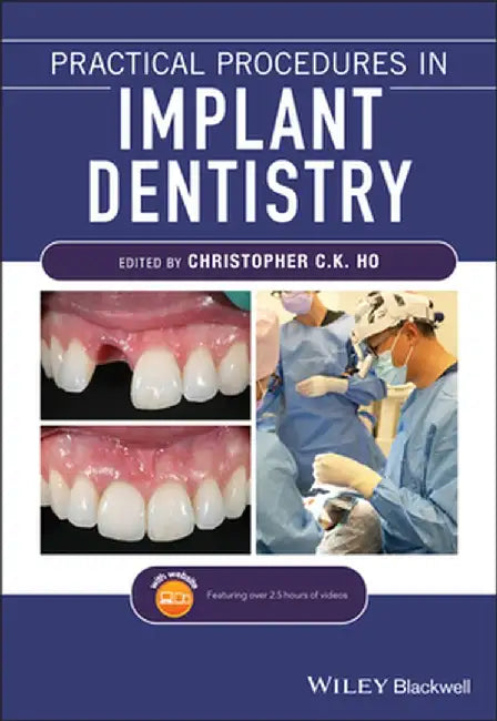 Practical Procedures in Implant Dentistry by Christopher C. K. Ho