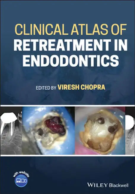Clinical Atlas Of Retreatment In Endodontics by CHOPRA