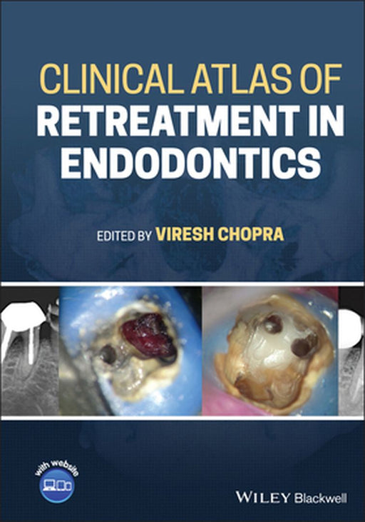 Clinical Atlas Of Retreatment In Endodontics by CHOPRA