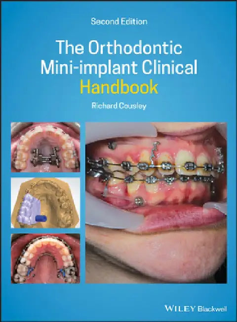 The Orthodontic Mini-Implant Clinical Handbook by Richard Cousley
