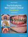 The Orthodontic Mini-Implant Clinical Handbook by Richard Cousley