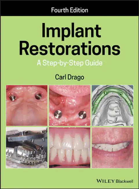 Implant Restorations: A Step-By-Step Guide by Carl Drago