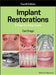 Implant Restorations: A Step-By-Step Guide by Carl Drago