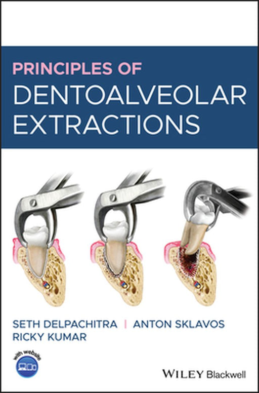 Principles Of Dentoalveolar Extractions by DELPACHITRA