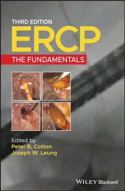 Ercp: The Fundamentals by Peter B. Cotton