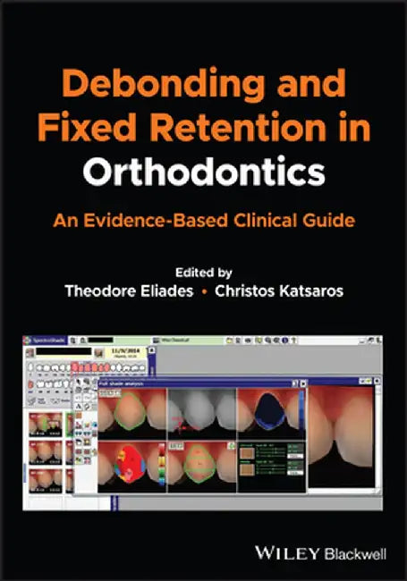 Debonding And Fixed Retention In Orthodontics: An Evidence-Based Clinical Guide by Eliades, Theodore