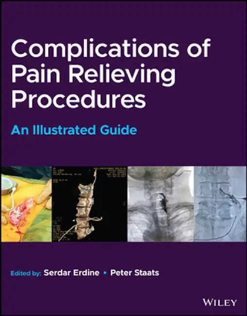 Complications of Pain-Relieving Procedures: An Illustrated Guide by Serdar Erdine