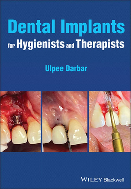 Dental Implants For Hygienists And Therapists by DARBAR
