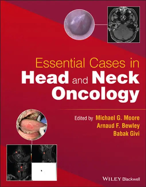 Essential Cases in Head and Neck Oncology by Babak Givi