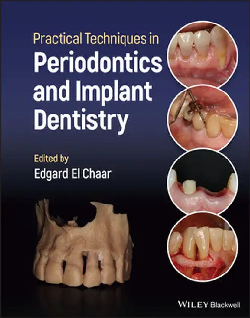 Practical Techniques In Periodontics And Implant Dentistry by EL CHAAR