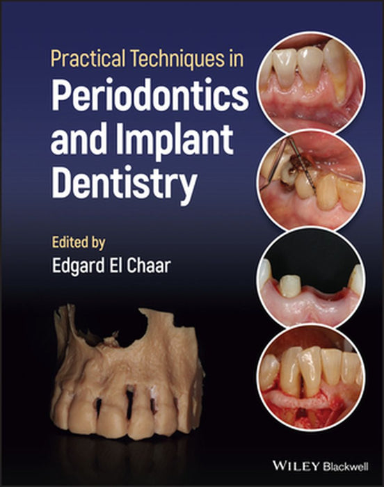 Practical Techniques In Periodontics And Implant Dentistry by EL CHAAR