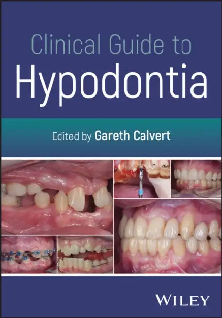 Clinical Guide to Hypodontia by Gareth Calvert