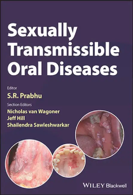 Sexually Transmissible Oral Diseases by Prabhu, S. R.
