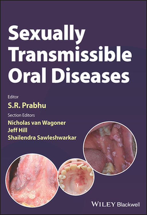 Sexually Transmissible Oral Diseases by Prabhu, S. R.