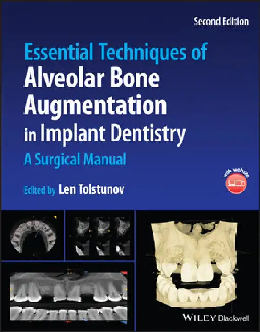 Essential Techniques of Alveolar Bone Augmentation in Implant Dentistry: A Surgical Manual by Len Tolstunov