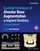Essential Techniques of Alveolar Bone Augmentation in Implant Dentistry: A Surgical Manual by Len Tolstunov