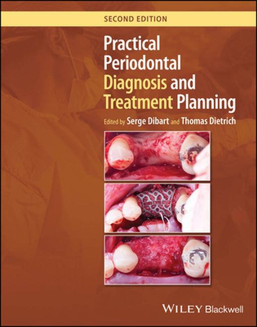 Practical Periodontal Diagnosis And Treatment Planning by Dibart, Serge