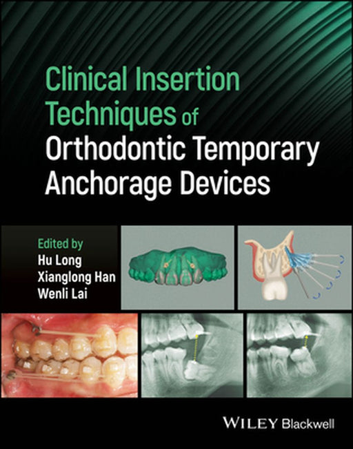 Clinical Insertion Techniques Of Orthodontic Temporary Anchorage Devices by LONG