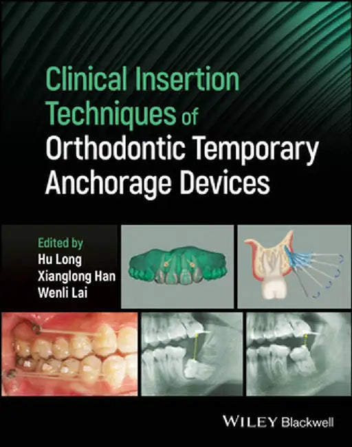 Clinical Insertion Techniques Of Orthodontic Temporary Anchorage Devices by LONG