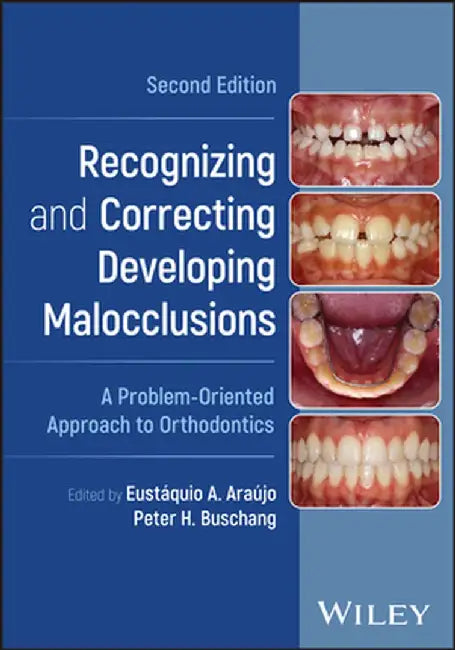 Recognizing and Correcting Developing Malocclusions: A Problem-Oriented Approach to Orthodontics by Eustáquio A. Araújo