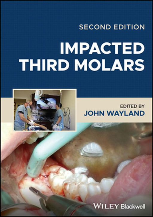 Impacted Third Molars by Wayland, John