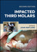 Impacted Third Molars by Wayland, John