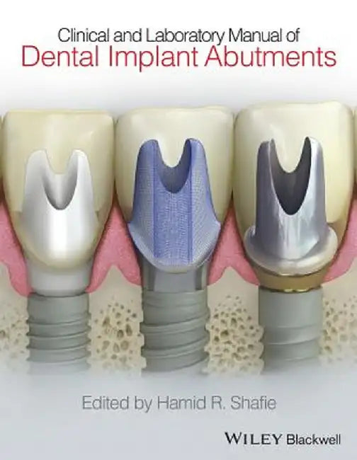 Clinical and Laboratory Manual of Dental Implant Abutments by Hamid R. Shafie