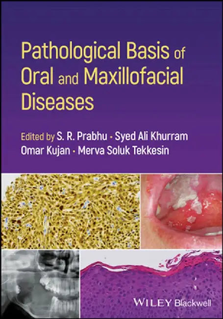 Pathological Basis of Oral and Maxillofacial Diseases by S. R. Prabhu