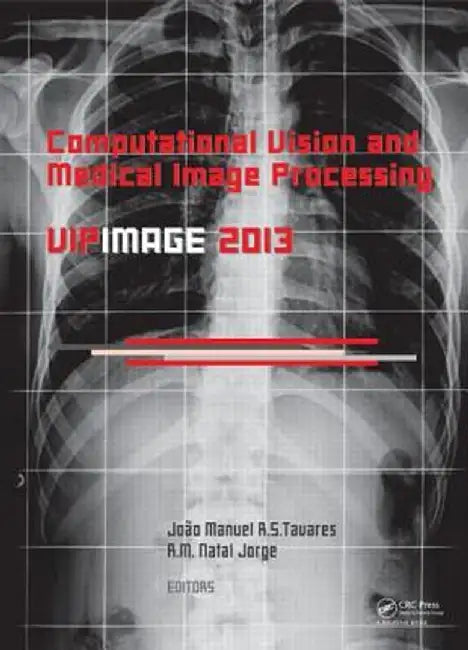 Computational Vision and Medical Image Processing IV: Vipimage 2013 by Joao Manuel RS Tavares