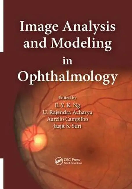 Image Analysis and Modeling in Ophthalmology by Eddie Y. K. Ng