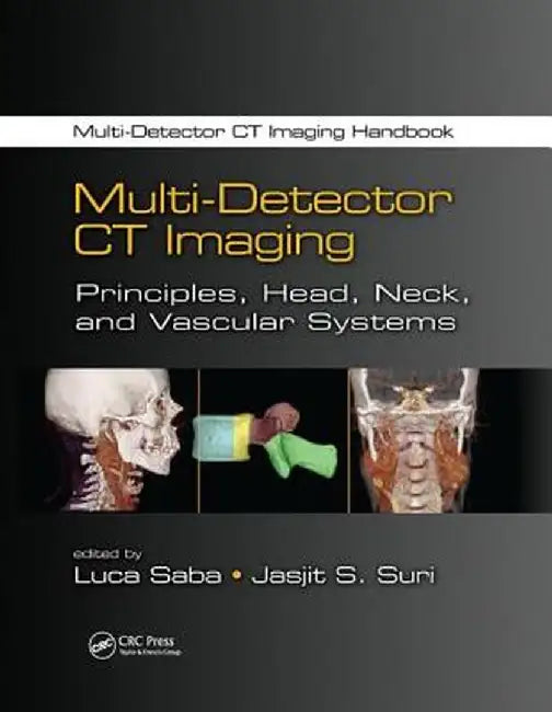 Multi-Detector CT Imaging: Principles, Head, Neck, and Vascular Systems by Luca Saba