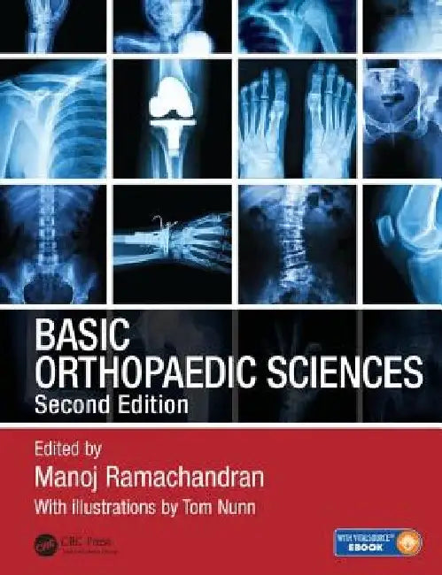 Basic Orthopaedic Sciences by Manoj Ramachandran