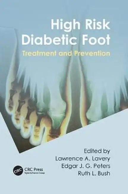 High Risk Diabetic Foot: Treatment and Prevention by Lawrence A. Lavery