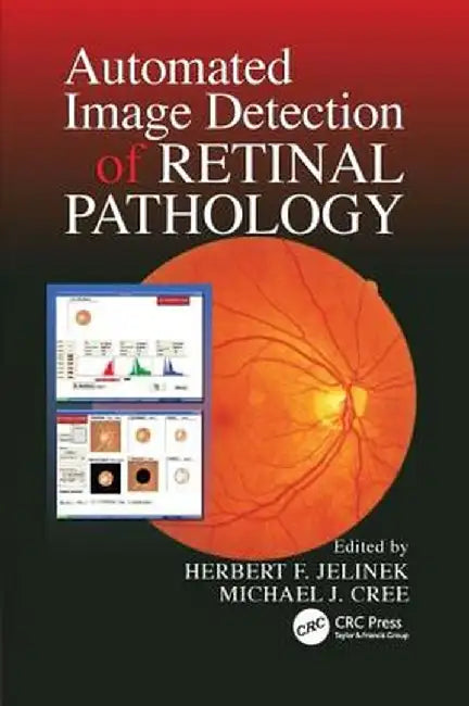 Automated Image Detection of Retinal Pathology by Herbert Jelinek