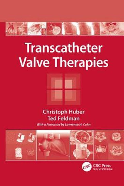 Transcatheter Valve Therapies by Christoph Huber