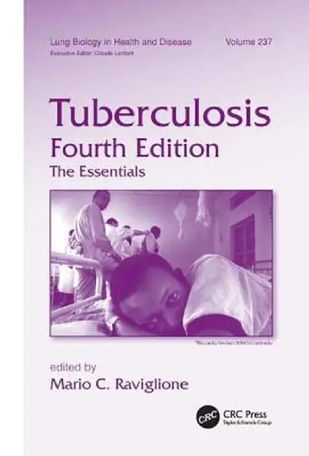 Tuberculosis: The Essentials, Fourth Edition by Mario C. Raviglione