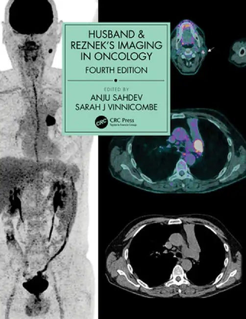 Husband & Reznek's Imaging in Oncology by Anju Sahdev