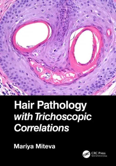 Hair Pathology with Trichoscopic Correlations by Mariya Miteva