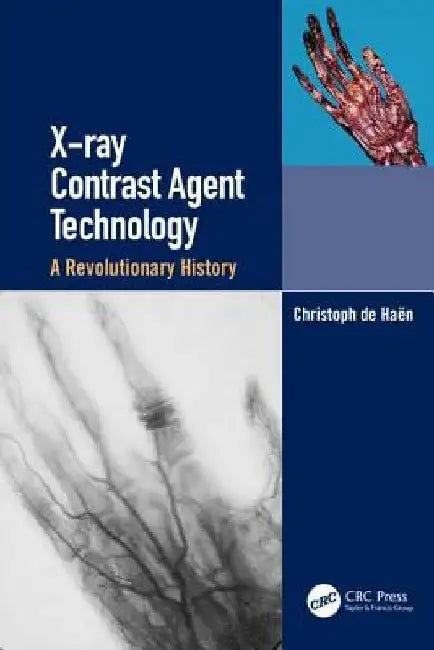X-Ray Contrast Agent Technology: A Revolutionary History by Christoph de Haen