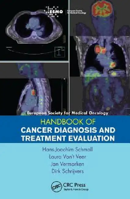 Esmo Handbook of Cancer Diagnosis and Treatment Evaluation by Hans-Joachim Schmoll