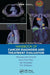 Esmo Handbook of Cancer Diagnosis and Treatment Evaluation by Hans-Joachim Schmoll