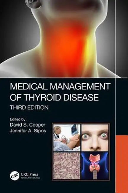 Medical Management of Thyroid Disease Third Edition by Cooper