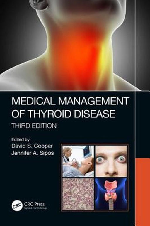 Medical Management of Thyroid Disease Third Edition by Cooper