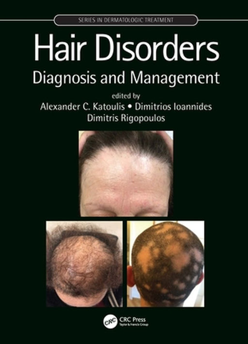 Hair Disorders by 
